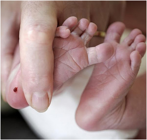 Xét nghiệm lấy máu gót chân trẻ sơ sinh