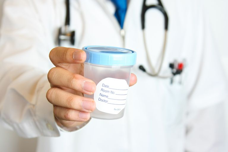 Lưu ý khi lấy mẫu tinh dịch