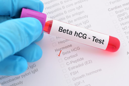 HCG – Ý nghĩa và Mối liên quan đến tuổi thai nhi