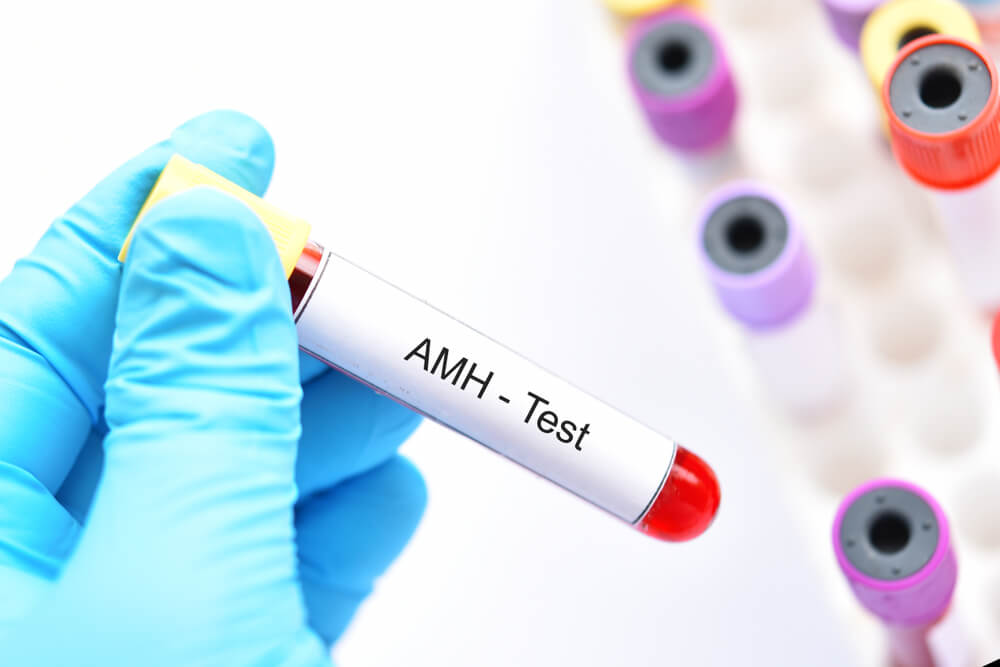 Vai trò của AMH trong các xét nghiệm lâm sàng