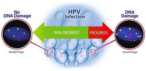 Hội thảo trực tuyến Triển khai thực hiện xét nghiệm DNA HPV như một công cụ sàng lọc cơ bản
