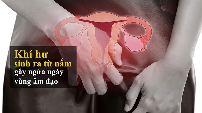 Viêm âm đạo có quan hệ tình dục được không?Viêm âm đạo có quan hệ tình dục được không?