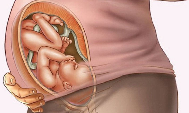 Sa dây rốn và cách xử trí