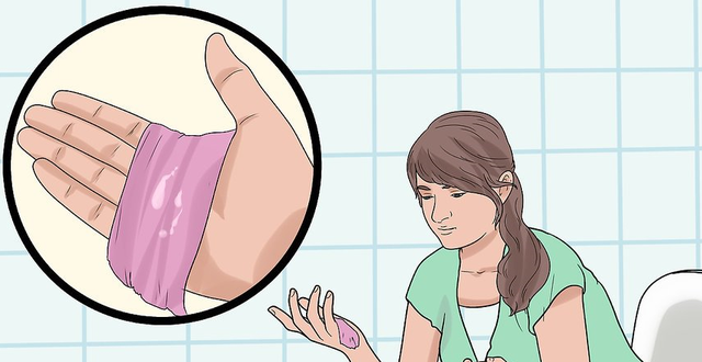 Khí hư: Khi nào là bất thường?Khí hư bất thường