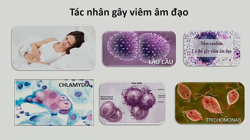 Viêm âm đạo ảnh hưởng thế nào trong quá trình mang thai bạn cần biết