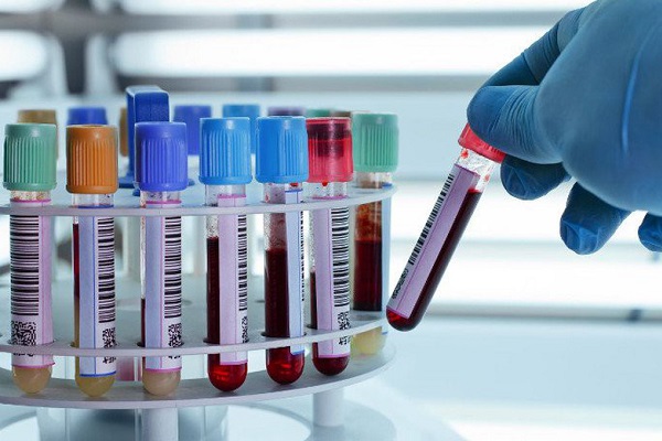 Triple Test và những điều mẹ bầu cần biết