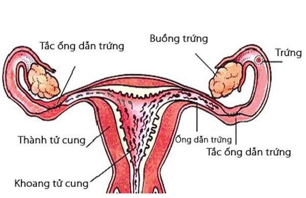 Tắc vòi trứng: Nguyên nhân và dấu hiệu nhận biết